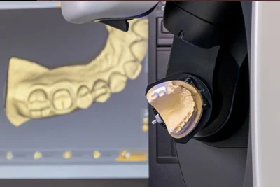 تصميم الابتسامة الرقمي