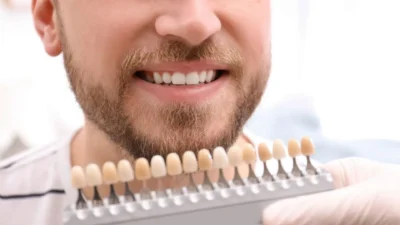 Teeth Whitening
