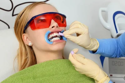 Teeth Whitening