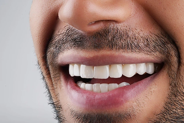 طب الأسنان التجميلي
